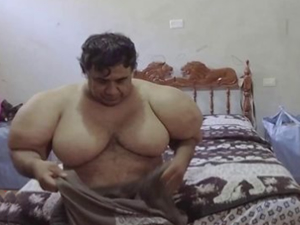 Perulu balıkçının vücudunda dalış sonrasında şişkinlik oluştu