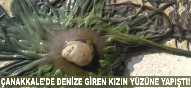 Çanakkale'de denize giren kızın yüzüne yapıştı!
