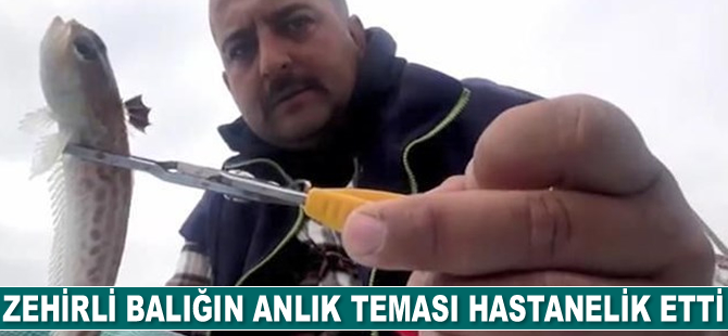 Zehirli balığın anlık teması hastanelik etti