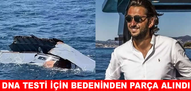 Halit Yukay’ın bedeninden DNA testi için parça alındı