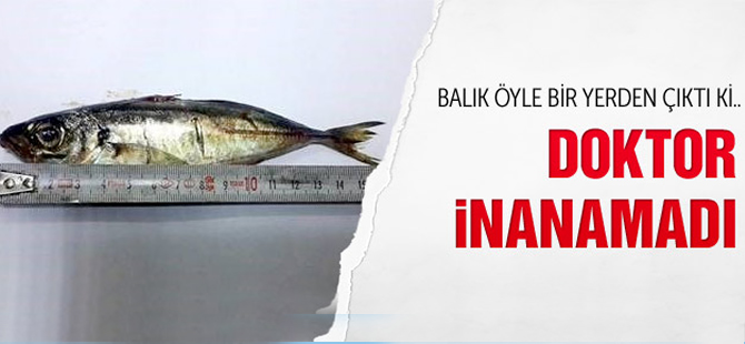 'Şifa' diye 16 cm'lik canlı balığı yutunca ölümden döndü