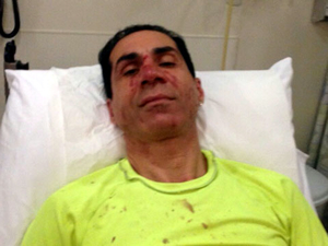 Reza Zarrab hakkında suç duyurusu yapan İBB Meclis üyesi saldırıya uğradı