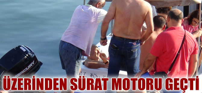 Yüzerken üzerinden sürat motoru geçen tatilcinin ayağı parçalandı