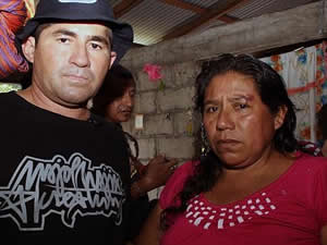 Teknedeki yol arkadaşını yiyen adama 1 milyon dolarlık dava