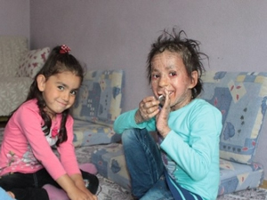 Azra'nın derisi balık pulu gibi dökülüyor