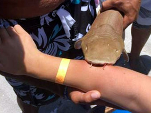 Kolunda köpekbalığıyla acile koştu