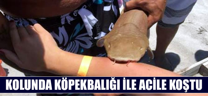 Kolunda köpekbalığıyla acile koştu