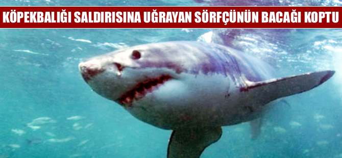 Köpekbalığı saldırısına uğrayan sörfçünün bacağı koptu