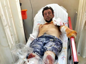 Bartın'da teknede patlama meydana geldi, 1 kişi yaralandı