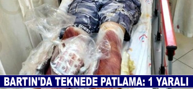 Bartın'da teknede patlama meydana geldi, 1 kişi yaralandı