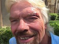 Virgin Havayolları'nın sahibi vatoz saldırısında yaralandı